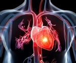 GLP-1 and SGLT2 inhibitors show promise in preventing recurrent stroke and heart attack