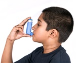 Rare STAT6 gene variant provides protection against severe asthma