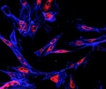 New research unravels mitochondria's role in breast cancer metastasis